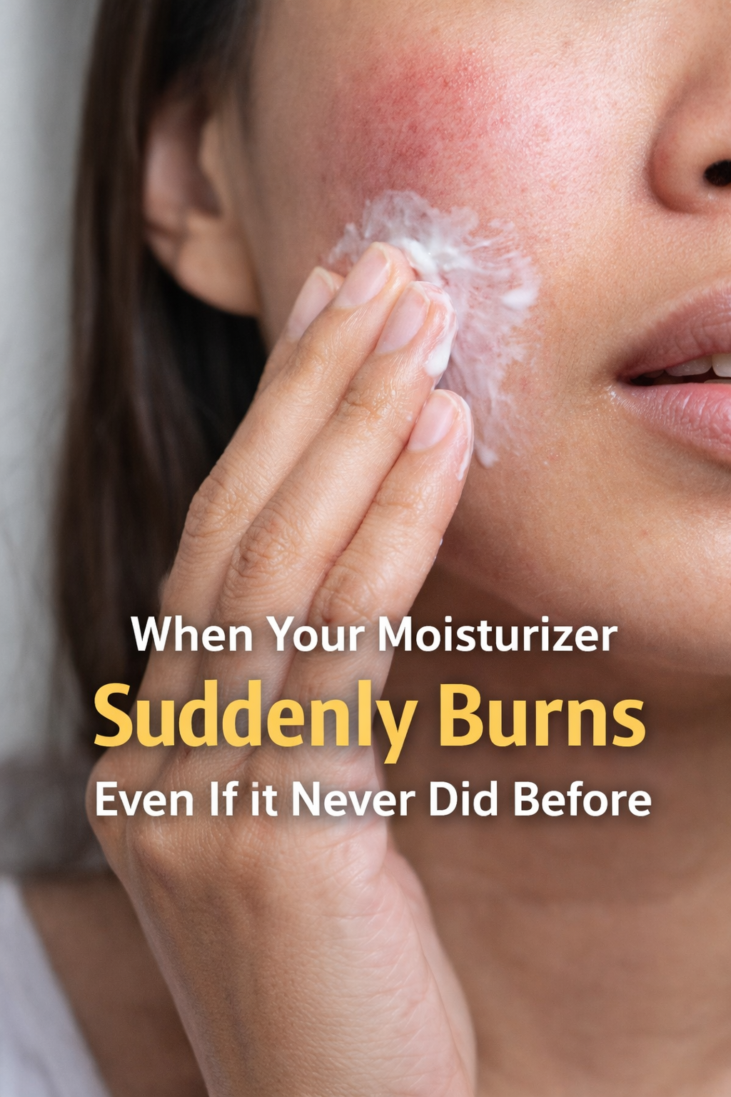 Close-up of irritated skin burning after applying moisturizer due to compromised skin barrier