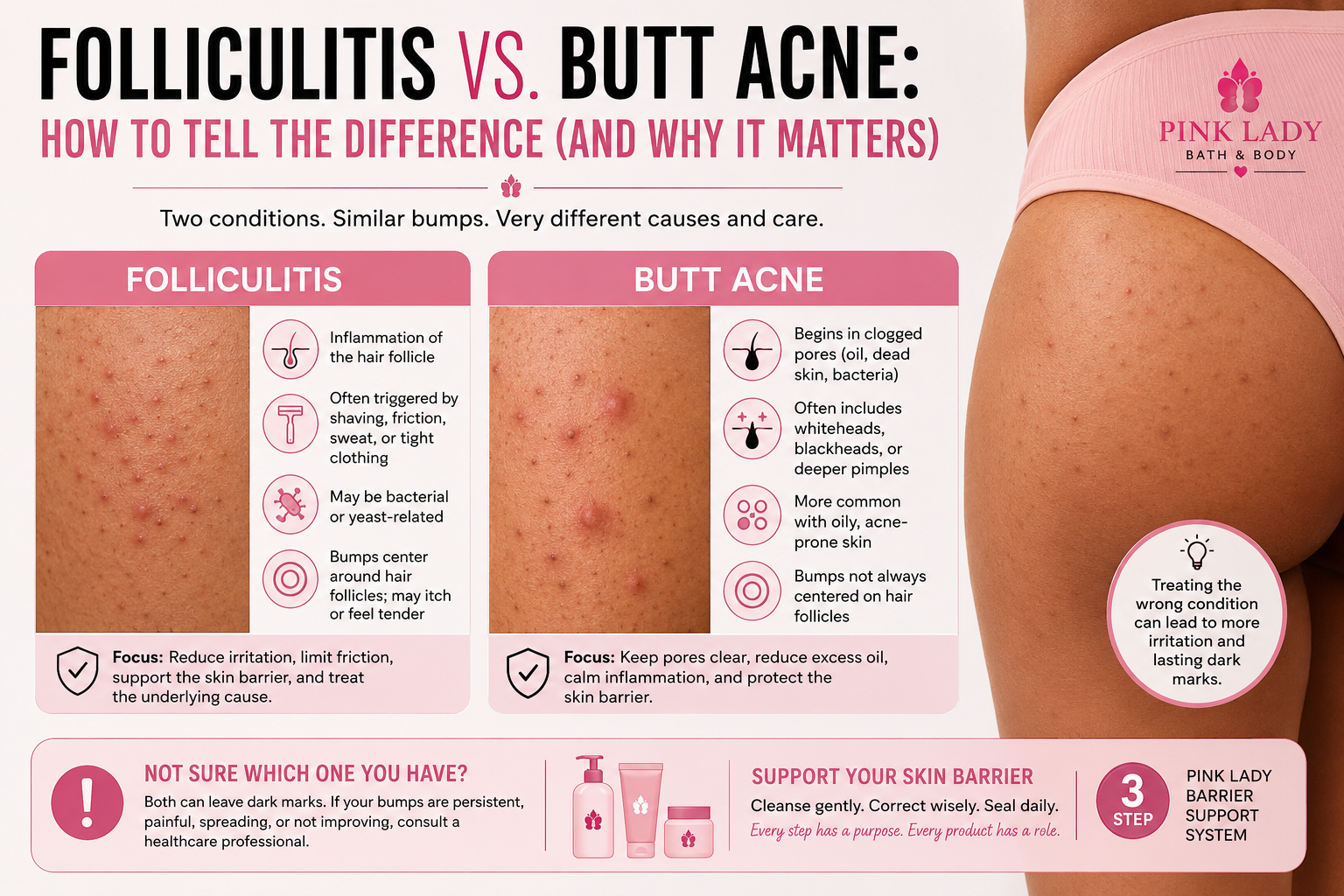 Folliculitis vs Butt Acne: Signs, Causes & Treatment Differences