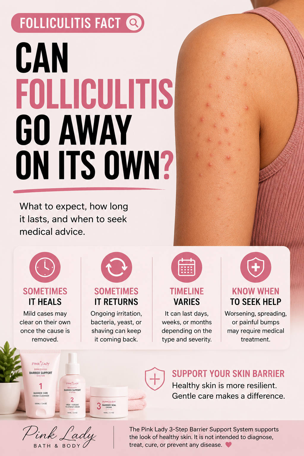 Can Folliculitis Go Away on Its Own?