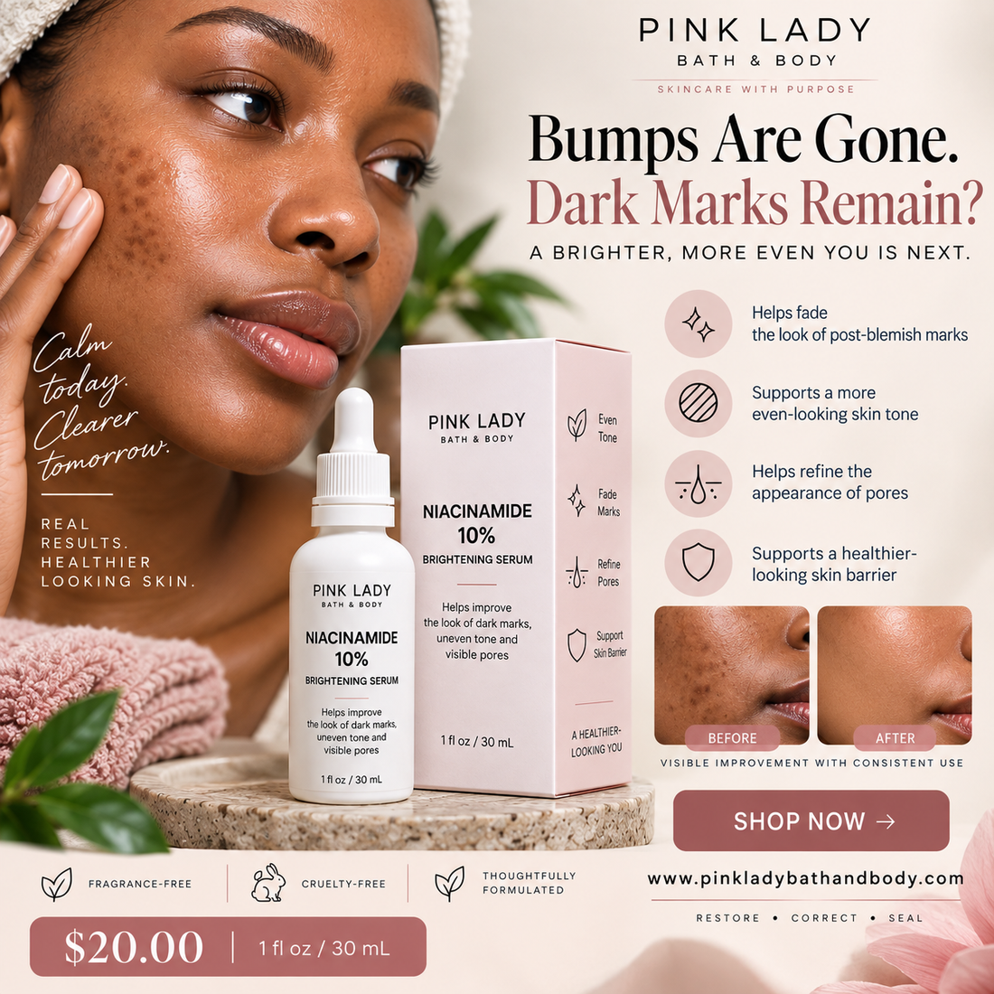 Pink Lady Niacinamide 10% Brightening Serum for post-blemish dark marks, uneven-looking skin tone and visible pores.